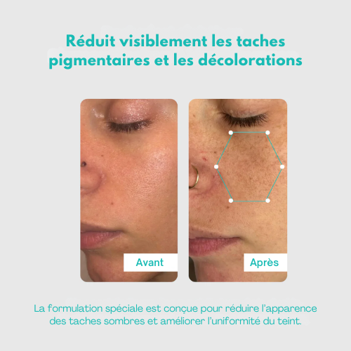 Luméa Pigment Correcteur