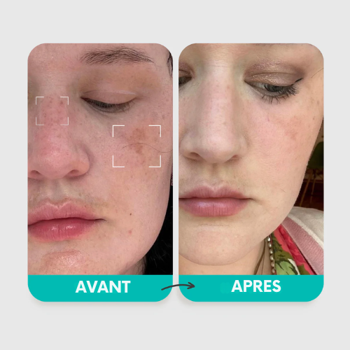 Luméa Pigment Correcteur