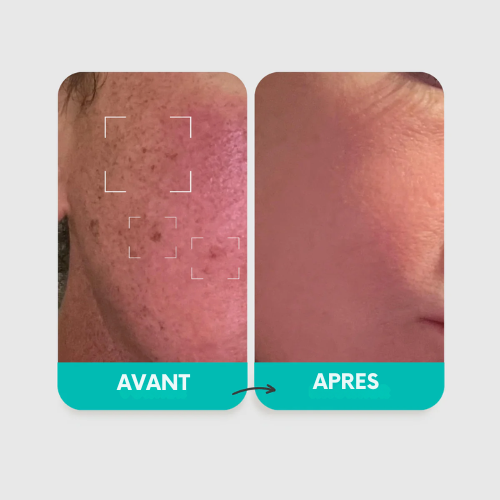 Luméa Pigment Correcteur